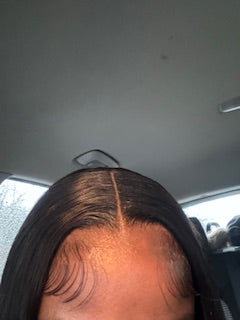 HD FRONTALS